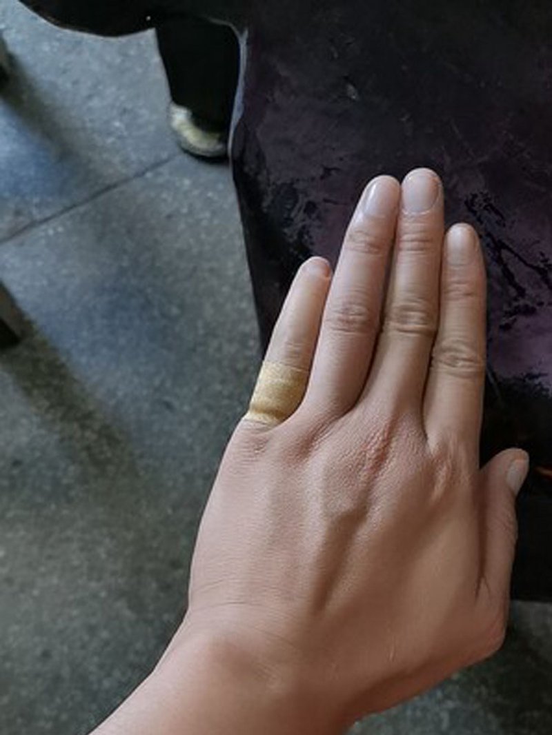 探索假手指研发新动态